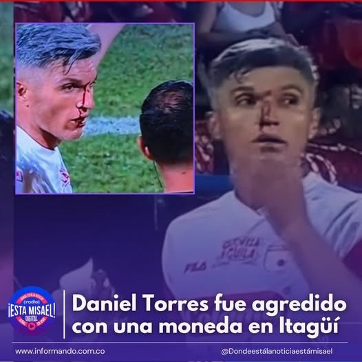 Daniel Torres fue agredido con una moneda en Itagüí El futbolista Daniel