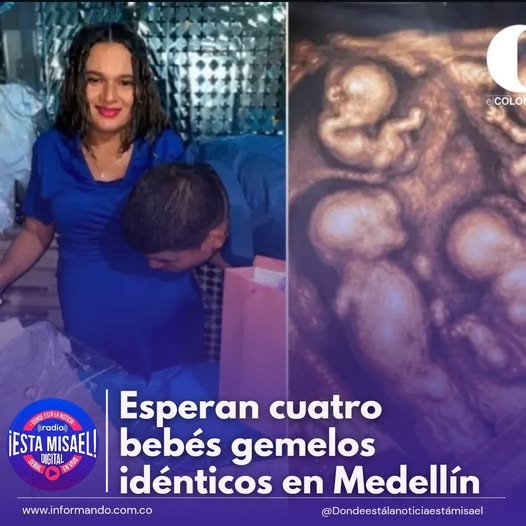 Esperan cuatro bebés gemelos idénticos en Medellín María Tapia y Jonatan Zapa